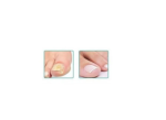 Gehwol Gel za nokte- Nail Repair 5ml - Slika 2